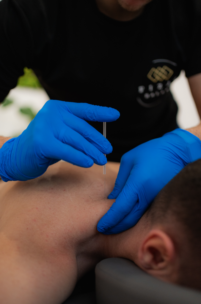 Akupunktura neurofunkcjonalna – zabieg w okolicy szyi
